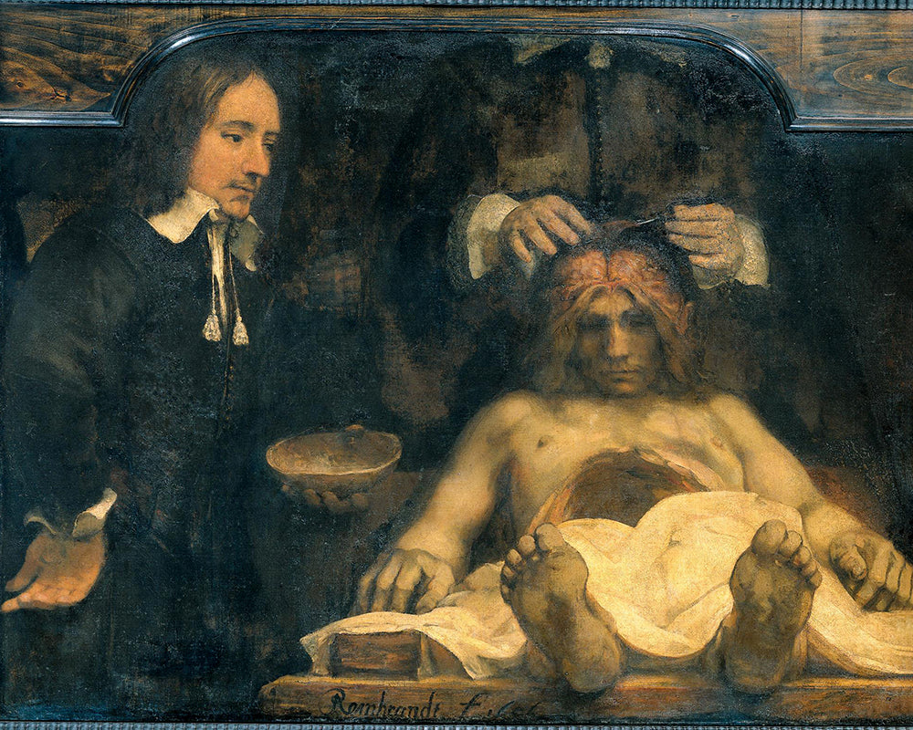 The Anatomical lesson of Dr. Jan Deyman by Rembrandt Harmenszoon van Rijn